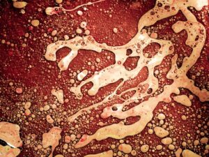 Analyzing the Role of Antibiotics in the Modern-Day Treatment of Infectious Diseases