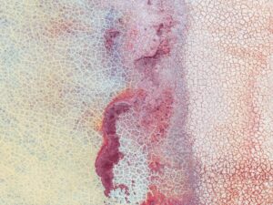 Understanding the Mechanisms of Antimicrobial Resistance and Its Role in Infectious Disease Management